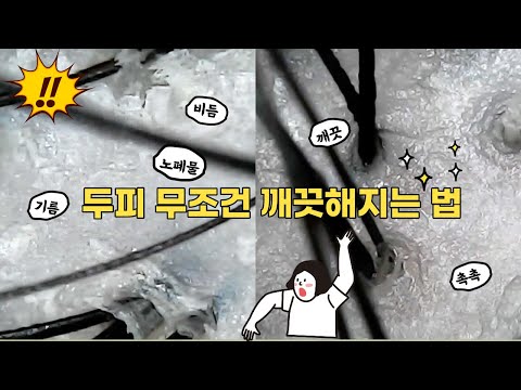 간지럽고 비듬 난리난 <strong>지성</strong> <strong>두피</strong> 샴푸법! <strong>두피</strong> 무조건 깨끗해짐