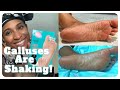 Trying The Epielle K-Beauty Foot Peeling Mask! AMAZING RESULTS! Quarantine Self Care | ChereaVS