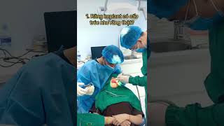 Các câu hỏi về Implant có thể bạn chưa biết #shorts Các câu hỏi về Implant có thể bạn chưa biết #shorts