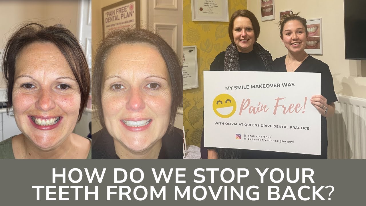 How Do We Stop Your Teeth From Moving Back After Treatment? - YouTube