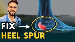 Heel Spurs: Home Treatment That Really Works screenshot 5