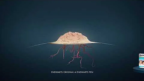 Jak odstranit bradavici nebo fibrom?