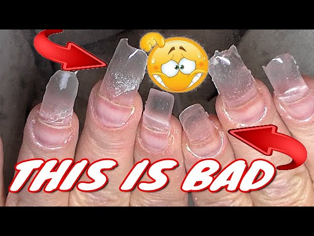 Nail care for nail biters: Strategies and tips for breaking a bad habit