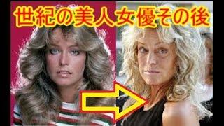 世紀の美人女優その後「壮絶な癌死ファラフォーセット【閲覧注意】＠【Restricted for Watching】A fierce death of Farrah Leni Fawcet