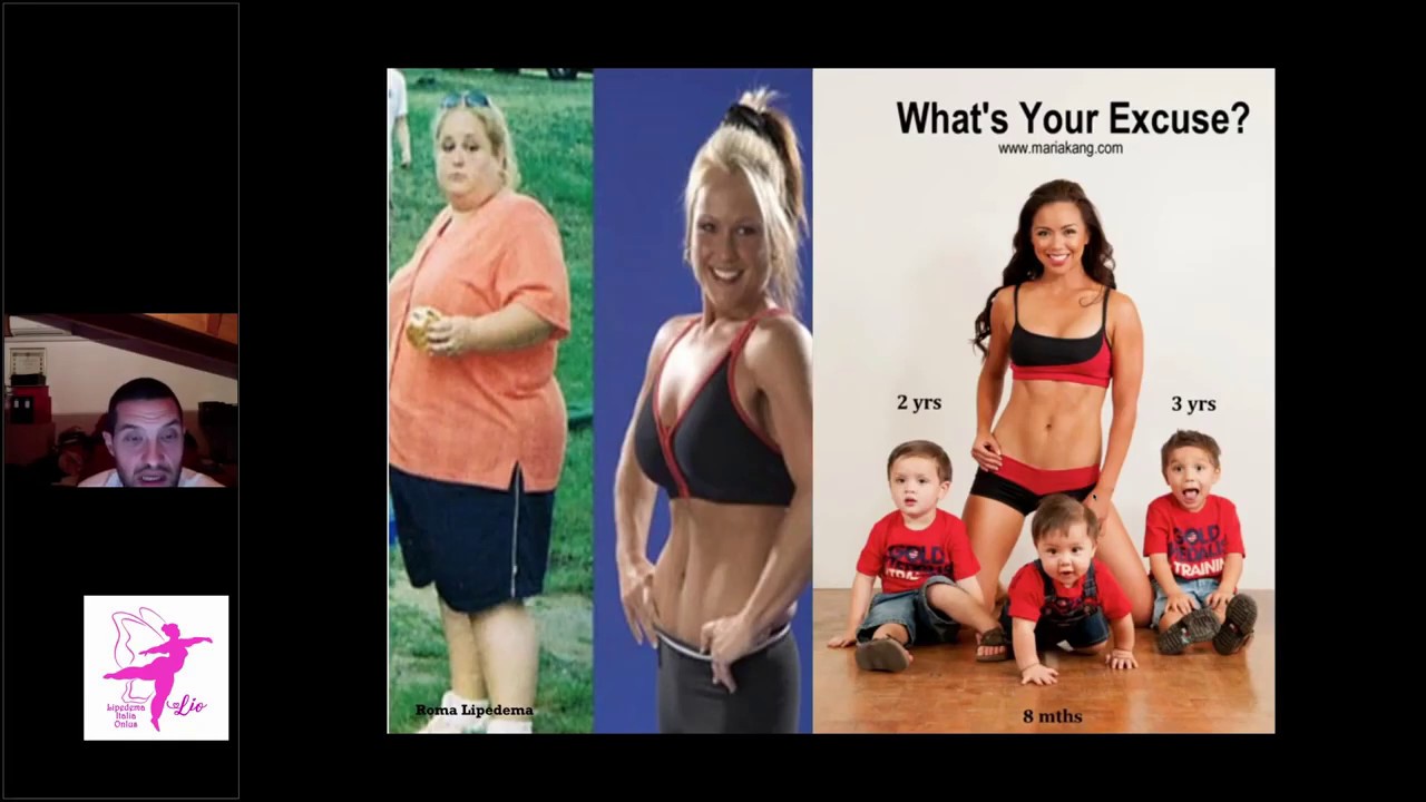 Daniele Di Pauli. Stigma, obesità e lipedema supporto psicologico al paziente. Convegno LIO 2019