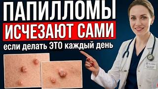 Папилломы и иммунитет после 50 — реальные причины роста и ошибки лечения | советы для пожилых