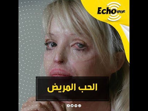 كاتي بيبر قصة المذيعة وعارضة الأزياء التي انتقم منها خطيبها بأبشع الطرق