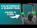 How to Prevent and Cure Elbow Pain During Calisthenics Training