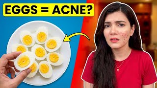 Is Egg Really Causing Your Acne? Dermatologist Analysis | #apoorvaupase Wealth