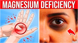 12 WARNING Signs Your Body NEEDS MORE Magnesium - (Magnesium Deficiency Symptoms)