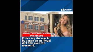UAbany Student fighting for her life after dirt bike hit and run