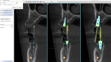 Owandy 3D Visualisation Simplant