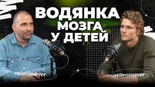 картинка: Лечение водянки мозга у ребенка