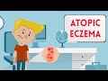 Atopic Eczema