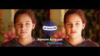 Photo Editing in Photoshop cs6  | Remove Acne And Soft skin | 2019 screenshot 2