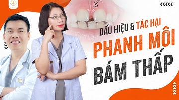 Dấu Hiệu Nhận Biết Phanh Môi Và Tác Hại Của Phanh Môi Bám Thấp | Bác sĩ Trung Long Biên