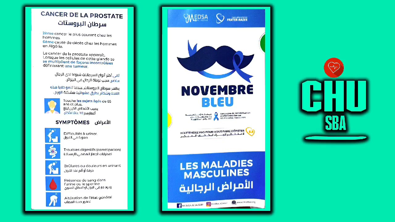 Depsitage Du Cancer De La Prostate Youtube