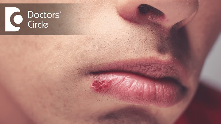 What causes a blister on your lip