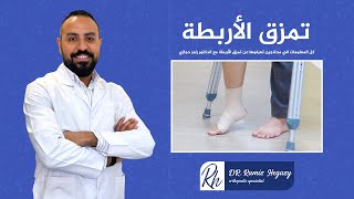 كل المعلومات الي محتاجين تعرفوها عن تمزق الأربطة | الدكتور رامز حجازي