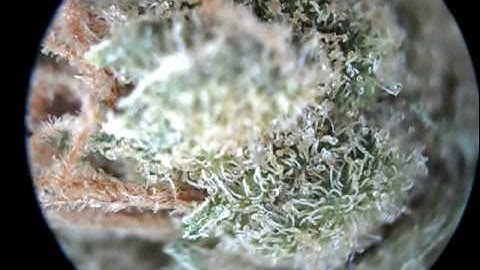 Best microscope for looking at trichomes