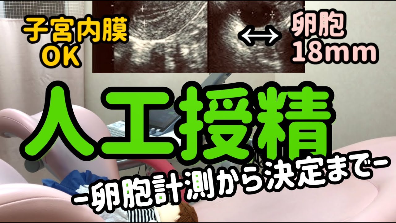 「人工授精　～卵胞計測から決定まで～」　『POSITIVE 妊活！』シリーズ　IVFなんばクリニック