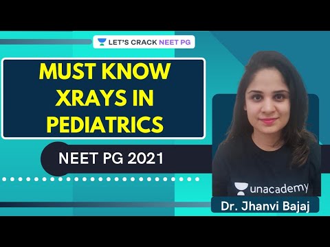 Must know  Xrays in Pediatrics | Pediatrics | NEET PG | Let's Crack NEET PG | Dr.Jhanvi