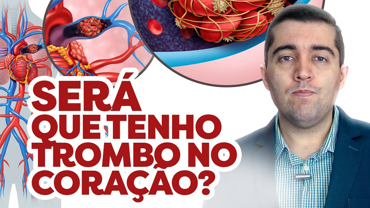 Trombo no coração: como desfazer coágulos e qual risco de embolia, AVC ...