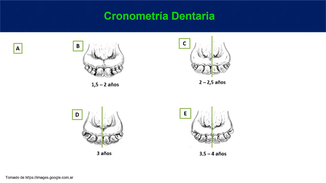 Cronometr a dentaria youtube