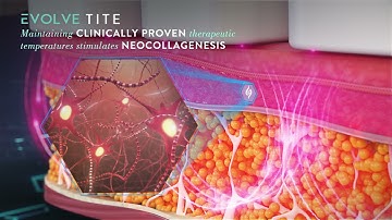 Inmode EVOLVEX - Animation