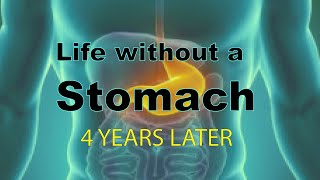 Esophagectomy 4 years later