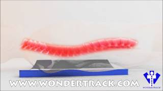 Wondertrack Back Support