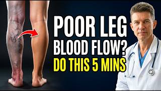 Poor Leg Circulation? 30-Second Test  3 Fast Fix Exercises