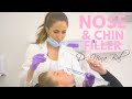 Nose Filler & Chin Filler | Side Profile Golden Ratio 💗 Dr. Nina Bal | London