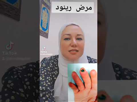 مرض رينود  الروماتيزم دكتورة وفاء جابر المناعة  