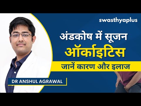 ऑर्काइटिस का इलाज कैसे करें? | Orchitis/ Inflammation of Testicles, in Hindi | Dr Anshul Agrawal