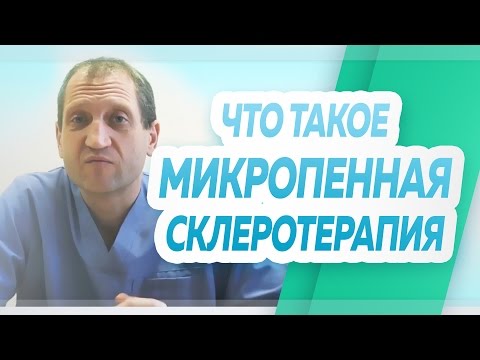 Что такое микропенная склеротерапия, которая используется флебологами для лечения болезней вен?