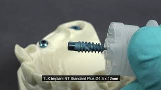 Démonstration de la pose de 3 implants Straumann® TLX