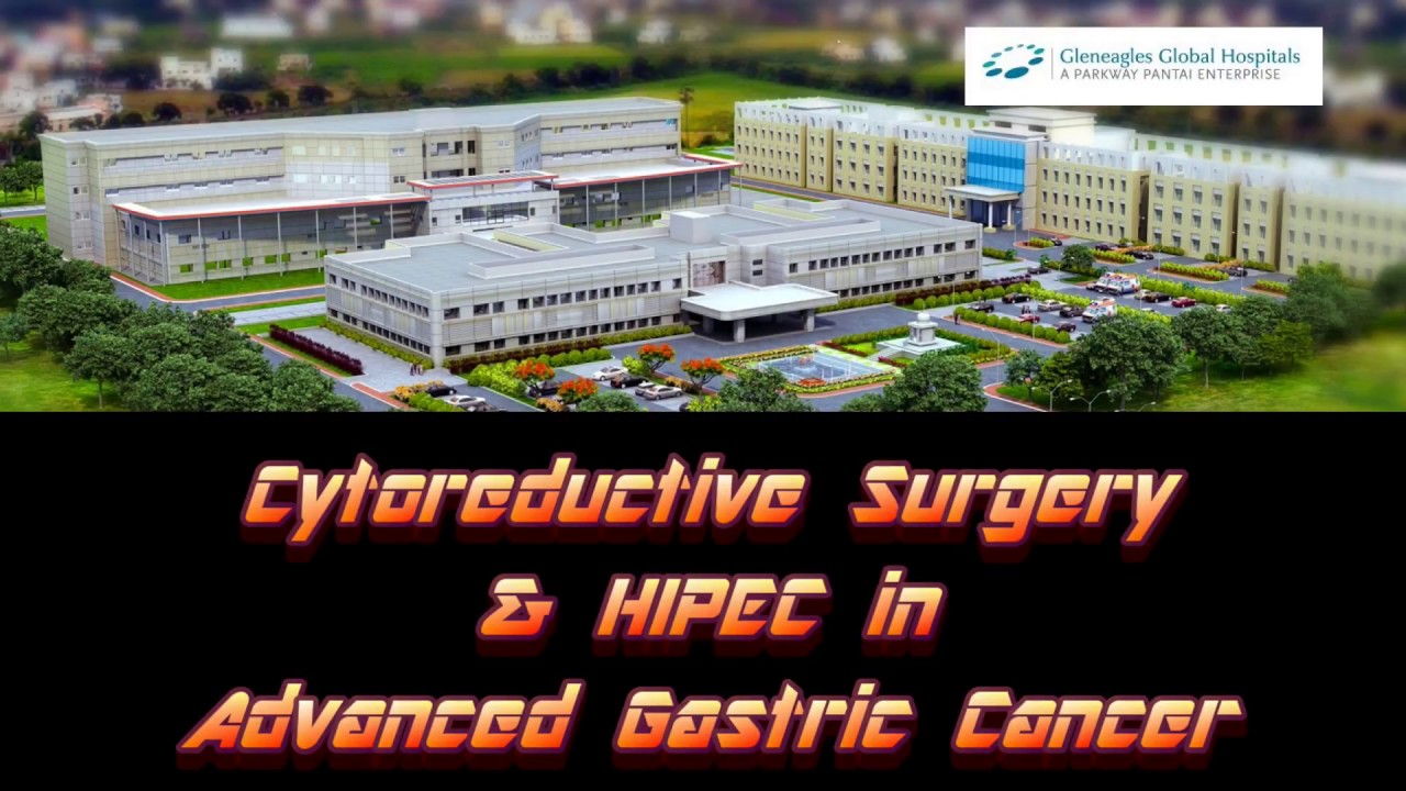 Advanced Gastric Cancer - HIPEC Therapy - YouTube