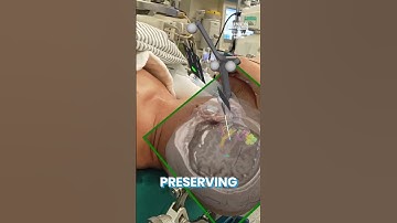 Brain Tumor Surgery with 3D Holographics