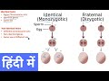 Types of Twins in Hindi