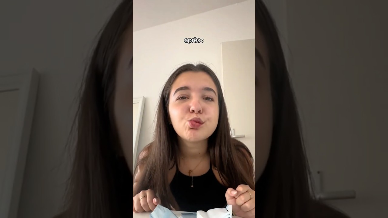 - 4 dents de sagesse d’un coup 🦷  