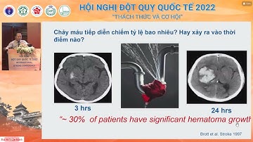 Session: Các Vấn đề Xuất huyết não