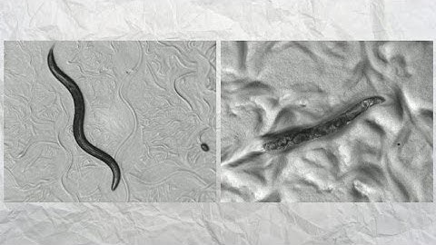 Chromosome 4 - How a worm is unlocking the secrets of ageing