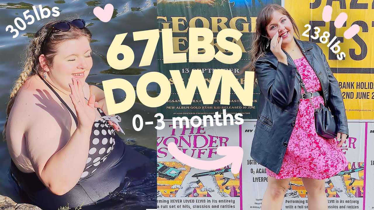 МОЙ ПУТЬ К ЖЕЛУДОЧНОМУ ШУНТИРОВАНИЮ НА СЕЙЧАС 🌸 0–3 месяца после операции по снижению веса