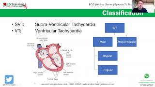 ECG Webinar Series | Episode 7 | Tachycardias & WPW screenshot 5