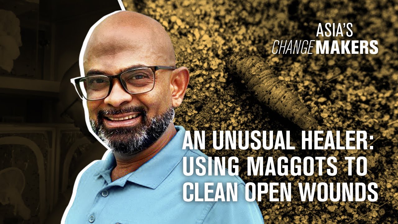 An unusual healer using maggots to clean open wounds youtube
