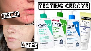 TESTING CERAVE FOR A MONTH FOR ACNE + ACNE SCARRING screenshot 3