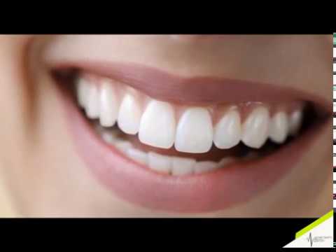 Имплантация. система альфа- био. Стоматология