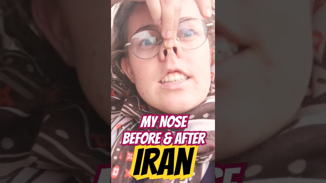 Why Do Iranians Want Nose Jobs?! 👃