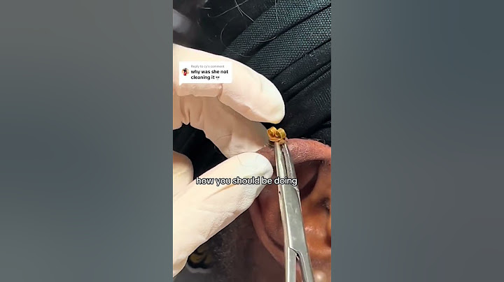Base Laboratories' Piercing Aftercare Spray. Ensure optimal body and ear piercing healing ❤️‍🩹